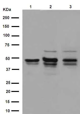 Western blot - Anti-IKK gamma/NEMO antibody [EPR16629] (AB178872)