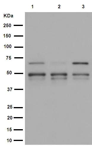 Western blot - Anti-IKK gamma/NEMO antibody [EPR16629] (AB178872)