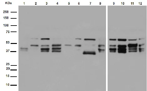 Western blot - Anti-IKK gamma/NEMO antibody [EPR16629] (AB178872)