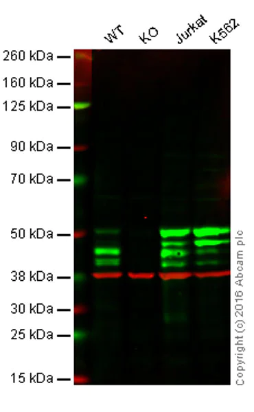 Western blot - Anti-IKK gamma/NEMO antibody [EPR16629] (AB178872)