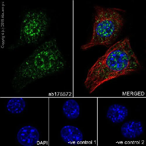 Immunocytochemistry/ Immunofluorescence - Anti-IKK gamma/NEMO antibody [EPR16629] - BSA and Azide free (AB230832)