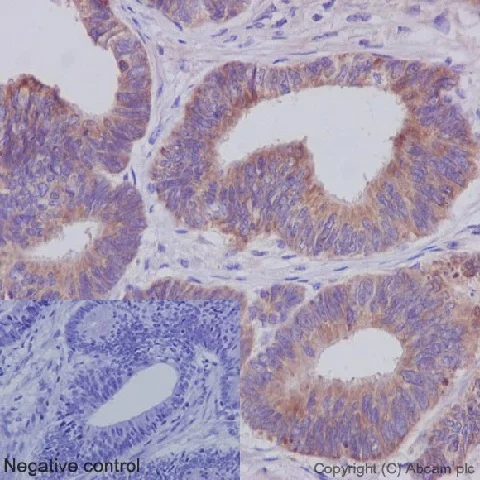 Immunohistochemistry (Formalin/PFA-fixed paraffin-embedded sections) - Anti-IKK gamma/NEMO antibody [EPR16629] - BSA and Azide free (AB230832)