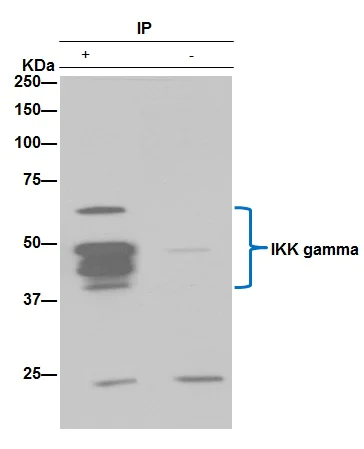 Immunoprecipitation - Anti-IKK gamma/NEMO antibody [EPR16629] - BSA and Azide free (AB230832)