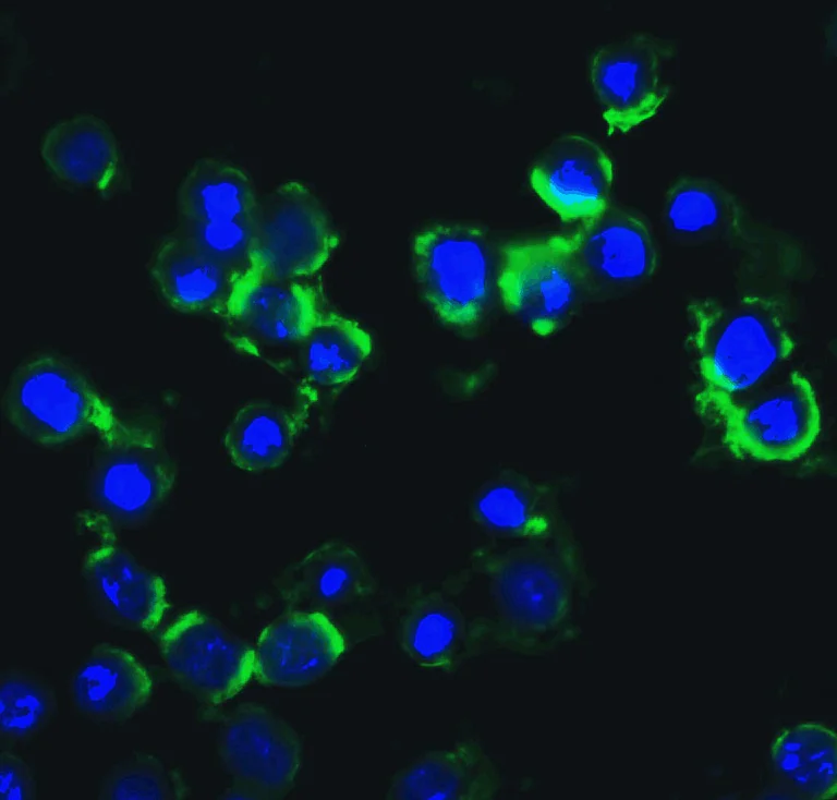 Immunocytochemistry/ Immunofluorescence - Anti-IKKi/IKKe antibody (AB7891)