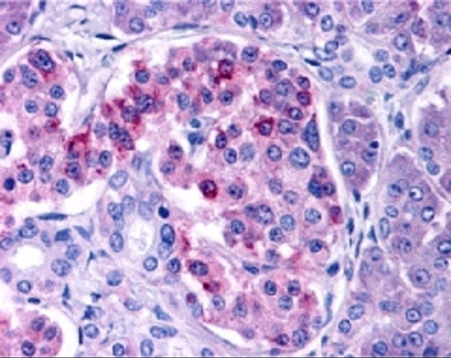 Immunohistochemistry (Formalin/PFA-fixed paraffin-embedded sections) - Anti-IKKi/IKKe antibody (AB7891), expandable thumbnail