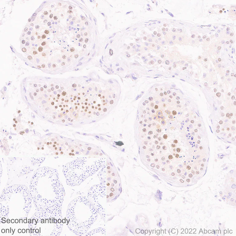 Immunohistochemistry (Formalin/PFA-fixed paraffin-embedded sections) - Anti-IKKi/IKKe+NAK/TBK1 antibody [EPR25258-15] (AB289973)