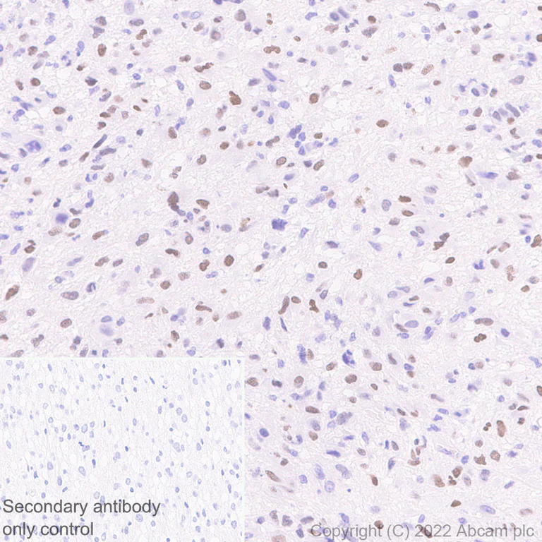 Immunohistochemistry (Formalin/PFA-fixed paraffin-embedded sections) - Anti-IKKi/IKKe+NAK/TBK1 antibody [EPR25258-15] (AB289973)