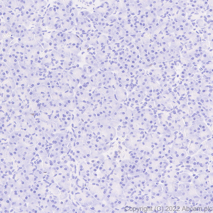 Immunohistochemistry (Formalin/PFA-fixed paraffin-embedded sections) - Anti-IKKi/IKKe+NAK/TBK1 antibody [EPR25258-15] (AB289973)