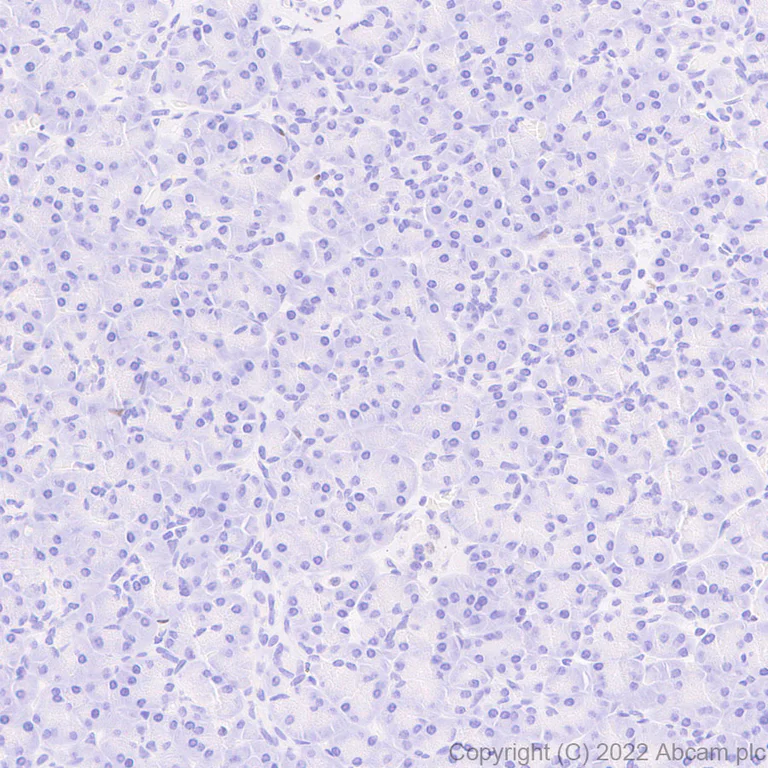 Immunohistochemistry (Formalin/PFA-fixed paraffin-embedded sections) - Anti-IKKi/IKKe+NAK/TBK1 antibody [EPR25258-15] (AB289973)