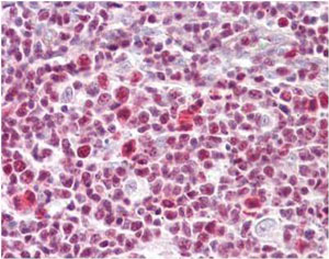 Immunohistochemistry (Formalin/PFA-fixed paraffin-embedded sections) - Anti-IKZF3 antibody (AB134288)