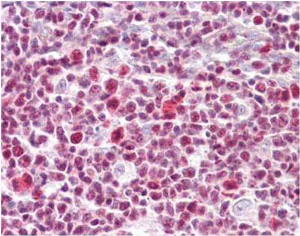 Immunohistochemistry (Formalin/PFA-fixed paraffin-embedded sections) - Anti-IKZF3 antibody (AB134288)