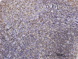Immunohistochemistry (Formalin/PFA-fixed paraffin-embedded sections) - Anti-IKZF3 antibody (AB88513)
