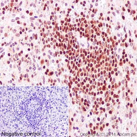 Immunohistochemistry (Formalin/PFA-fixed paraffin-embedded sections) - Anti-IKZF3 antibody [EPR9342(B)] (AB139408)