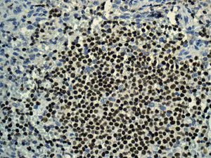 Immunohistochemistry (Formalin/PFA-fixed paraffin-embedded sections) - Anti-IKZF3 antibody [EPR9342(B)] (AB139408)