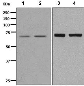 Western blot - Anti-IKZF3 antibody [EPR9342(B)] (AB139408)