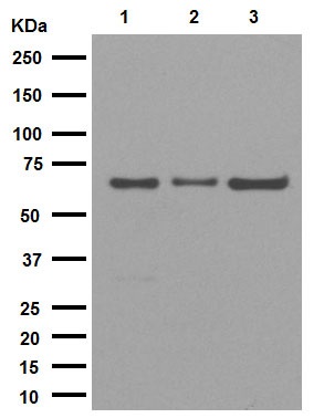 Western blot - Anti-IKZF3 antibody [EPR9342(B)] (AB139408), expandable thumbnail
