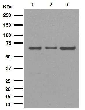 Western blot - Anti-IKZF3 antibody [EPR9342(B)] (AB139408)