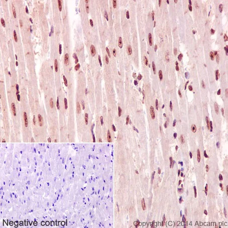 Immunohistochemistry (Formalin/PFA-fixed paraffin-embedded sections) - Anti-IKZF3 antibody [EPR9342(B)] - BSA and Azide free (AB192678)