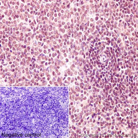 Immunohistochemistry (Formalin/PFA-fixed paraffin-embedded sections) - Anti-IKZF3 antibody [EPR9342(B)] - BSA and Azide free (AB192678)