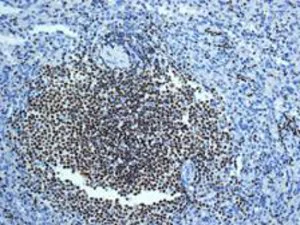 Immunohistochemistry (Formalin/PFA-fixed paraffin-embedded sections) - Anti-IKZF3 antibody [EPR9343(B)] - BSA and Azide free (AB224283)