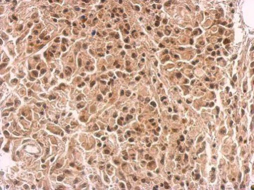 Immunohistochemistry (Formalin/PFA-fixed paraffin-embedded sections) - Anti-IKZF4 antibody (AB183625)