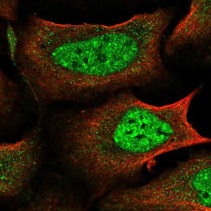 Immunocytochemistry/ Immunofluorescence - Anti-IKZF4 antibody (AB220329)