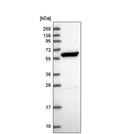 Western blot - Anti-IKZF4 antibody (AB220329)