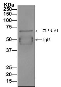 Immunoprecipitation - Anti-IKZF4 antibody [EPR11804] (AB170957), expandable thumbnail