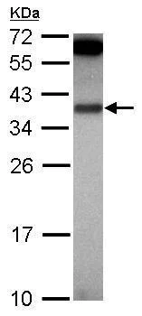 Western blot - Anti-IL-1 alpha antibody (AB227482)