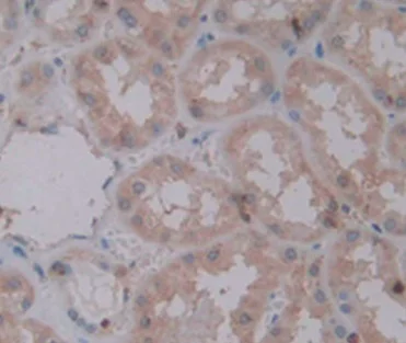 Immunohistochemistry (Formalin/PFA-fixed paraffin-embedded sections) - Anti-IL-1 alpha antibody [C1] (AB239517)