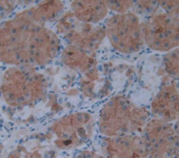 Immunohistochemistry (Formalin/PFA-fixed paraffin-embedded sections) - Anti-IL-1 alpha antibody [C1] (AB239517)