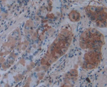 Immunohistochemistry (Formalin/PFA-fixed paraffin-embedded sections) - Anti-IL-1 alpha antibody [C1] (AB239517)