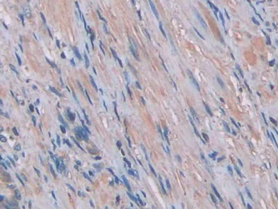 Immunohistochemistry (Formalin/PFA-fixed paraffin-embedded sections) - Anti-IL-1 alpha antibody [C1] (AB239517)