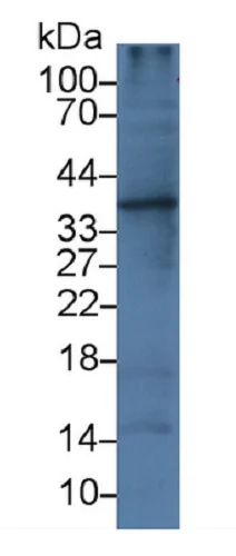 Western blot - Anti-IL-1 alpha antibody [C1] (AB239517)