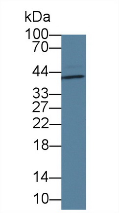 Western blot - Anti-IL-1 alpha antibody [C5] (AB239584), expandable thumbnail