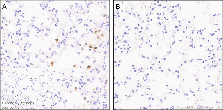 Immunohistochemistry (Formalin/PFA-fixed paraffin-embedded sections) - Anti-IL-1 alpha antibody [EPR25263-3] (AB300501)
