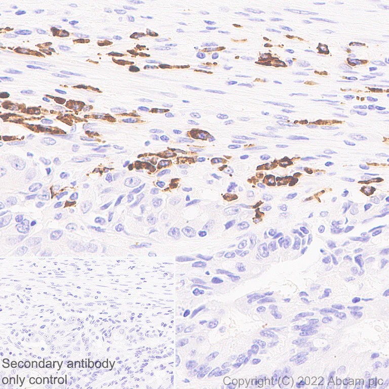 Immunohistochemistry (Formalin/PFA-fixed paraffin-embedded sections) - Anti-IL-1 alpha antibody [EPR25263-3] (AB300501)