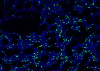 Immunohistochemistry (Formalin/PFA-fixed paraffin-embedded sections) - Anti-IL-1 alpha antibody [EPR25263-3] (AB300501)