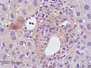 Immunohistochemistry (Formalin/PFA-fixed paraffin-embedded sections) - Anti-IL-1 beta antibody (AB2105)