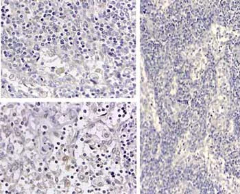 Immunohistochemistry (Formalin/PFA-fixed paraffin-embedded sections) - Anti-IL-1 beta antibody (AB2105)
