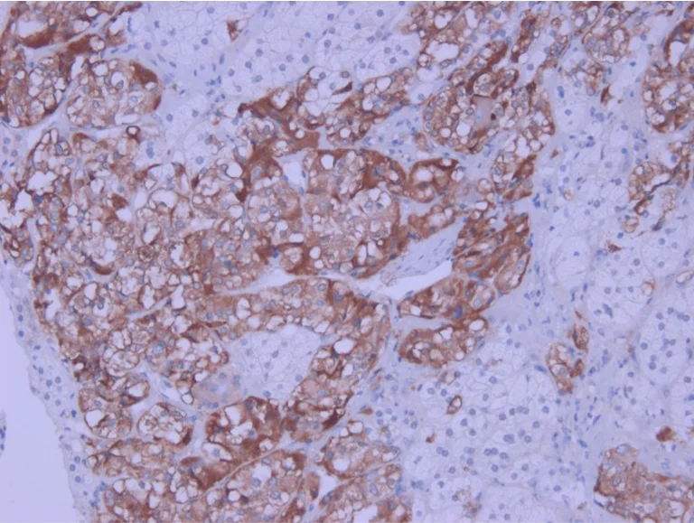 Immunohistochemistry (Formalin/PFA-fixed paraffin-embedded sections) - Anti-IL-1 beta antibody (AB9722)