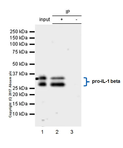 Immunoprecipitation - Anti-IL-1 beta antibody [EPR21086] (AB216995)