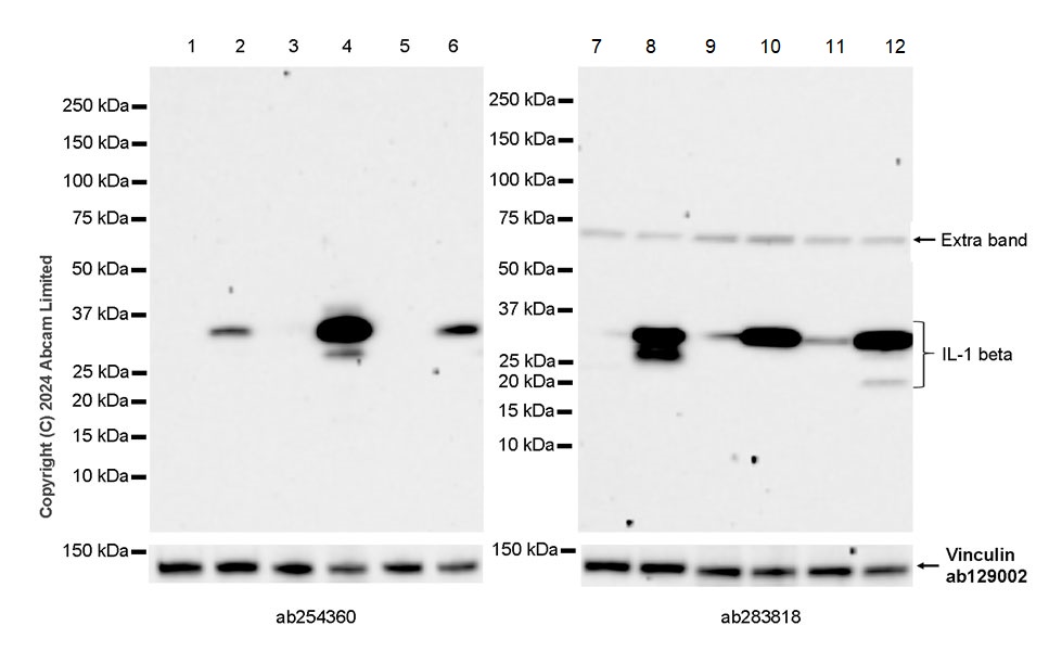 Western blot - Anti-IL-1 beta antibody [EPR23851-127] - BSA and Azide free (ab282021), expandable thumbnail