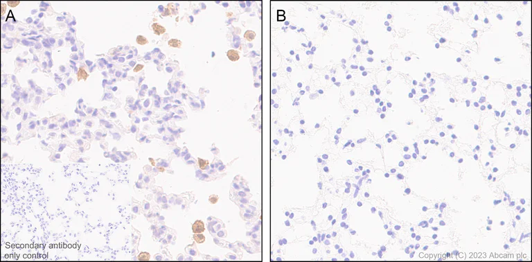 Immunohistochemistry (Formalin/PFA-fixed paraffin-embedded sections) - Anti-IL-1 beta antibody [EPR24895-116] (AB315084)