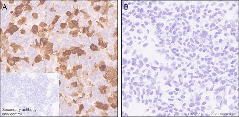 Immunohistochemistry (Formalin/PFA-fixed paraffin-embedded sections) - Anti-IL-1 beta antibody [EPR24895-116] (AB315084)