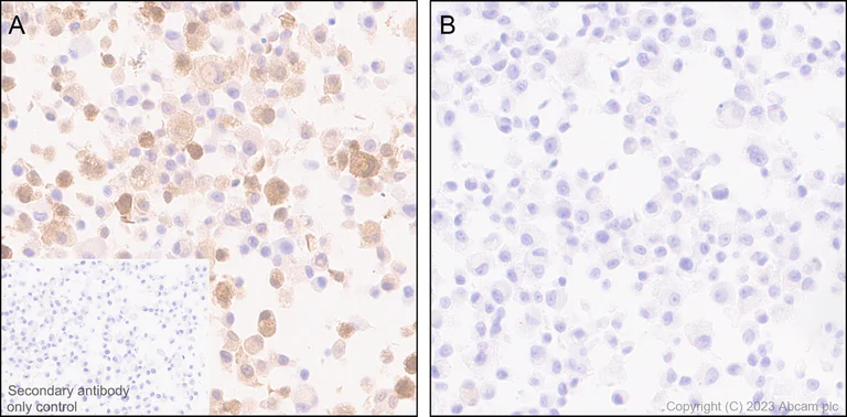 Immunohistochemistry (Formalin/PFA-fixed paraffin-embedded sections) - Anti-IL-1 beta antibody [EPR24895-116] (AB315084)