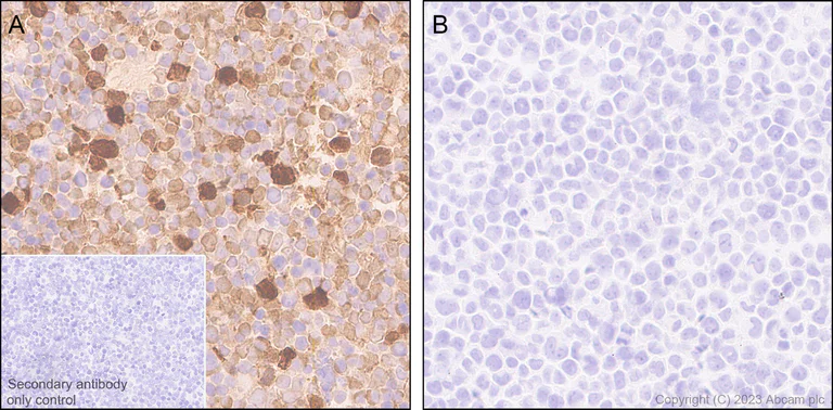 Immunohistochemistry (Formalin/PFA-fixed paraffin-embedded sections) - Anti-IL-1 beta antibody [EPR24895-116] - BSA and Azide free (AB315085)