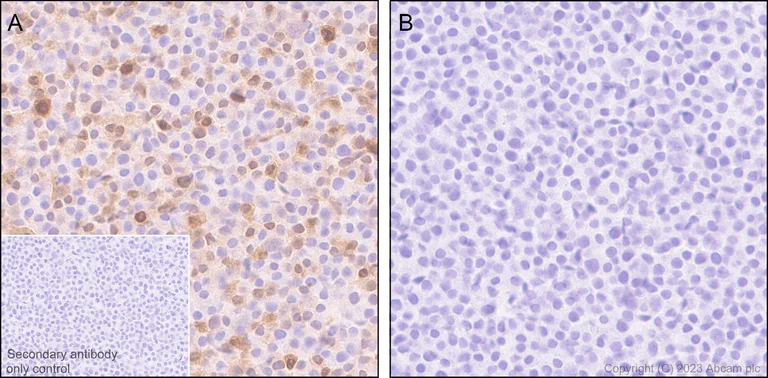 Immunohistochemistry (Formalin/PFA-fixed paraffin-embedded sections) - Anti-IL-1 beta antibody [EPR24895-116] - BSA and Azide free (AB315085)