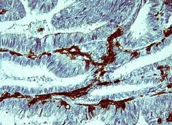 Immunohistochemistry (Formalin/PFA-fixed paraffin-embedded sections) - Anti-IL-1 beta antibody [OTI3E1] (AB156791)