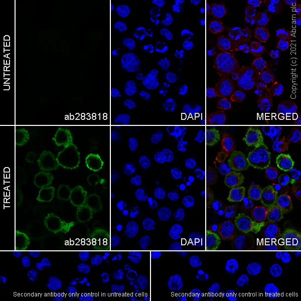 Immunocytochemistry - Anti-IL-1 beta antibody [RM1009] (AB283818)